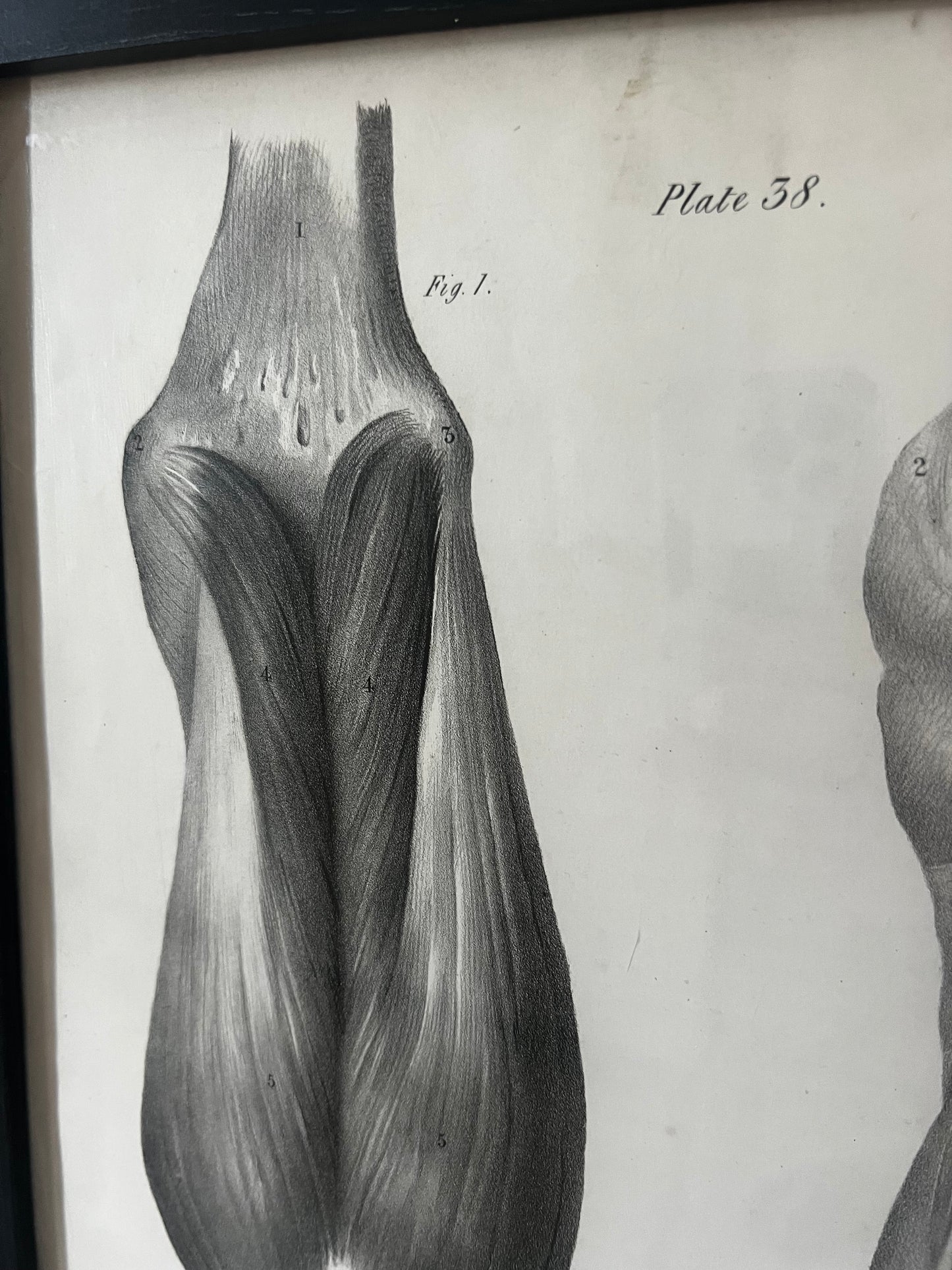 A wonderful set of old anatomical framed prints
