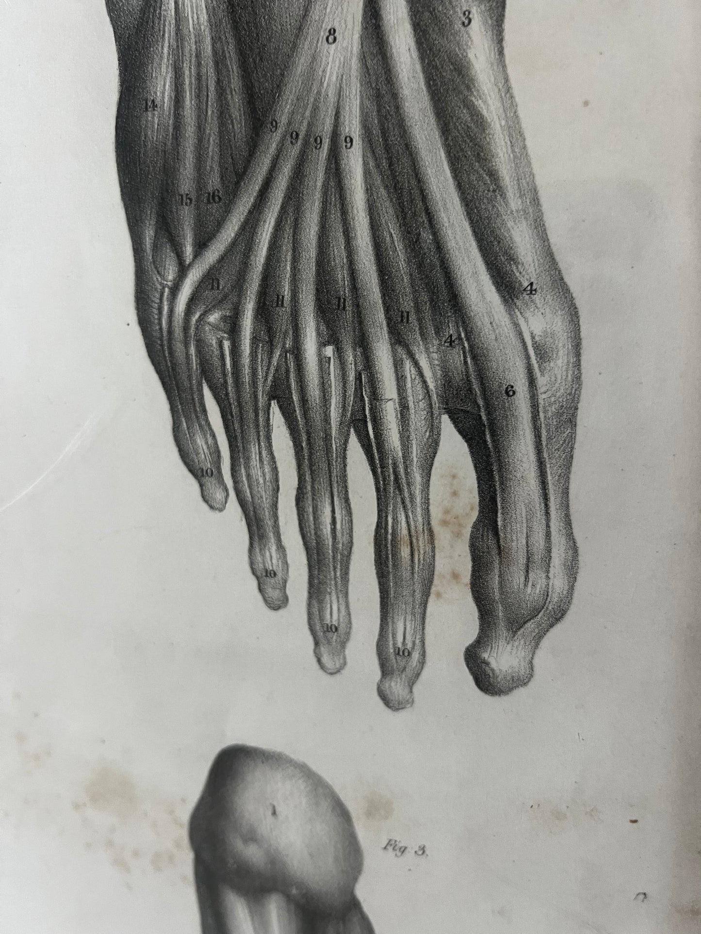 A wonderful set of old anatomical framed prints