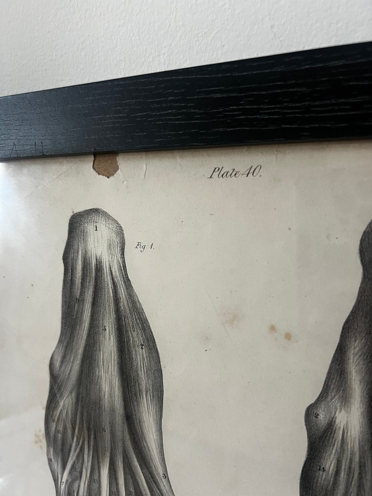 A wonderful set of old anatomical framed prints