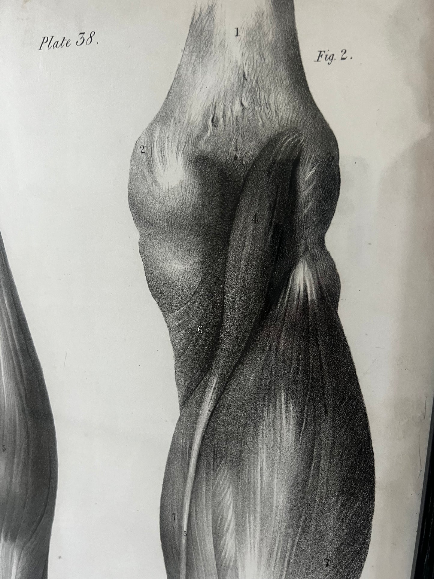 A wonderful set of old anatomical framed prints