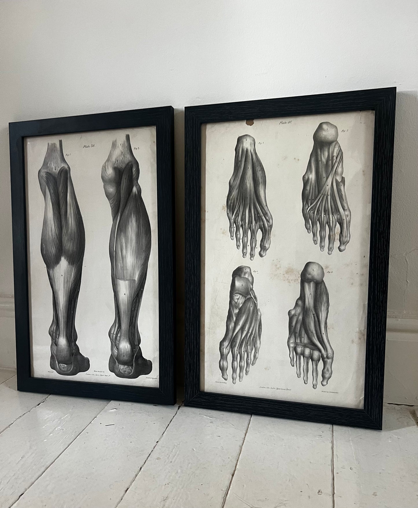 A wonderful set of old anatomical framed prints
