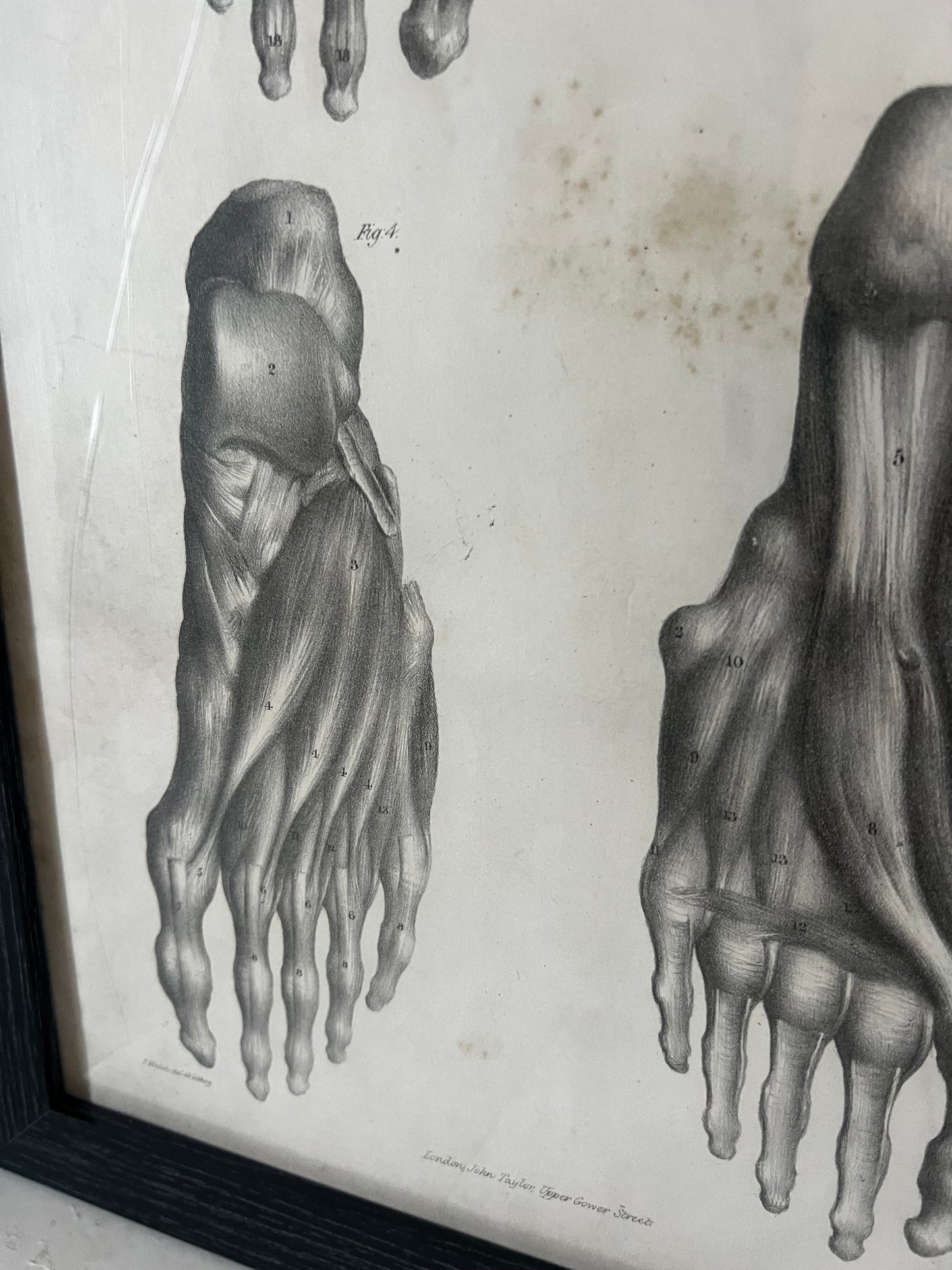 A wonderful set of old anatomical framed prints