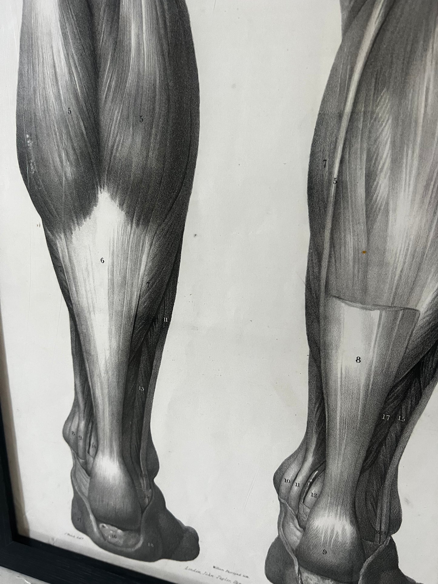 A wonderful set of old anatomical framed prints